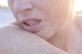 Sensitive Skin